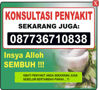 Illustration for article titled obat gatal kulit eksim kering
